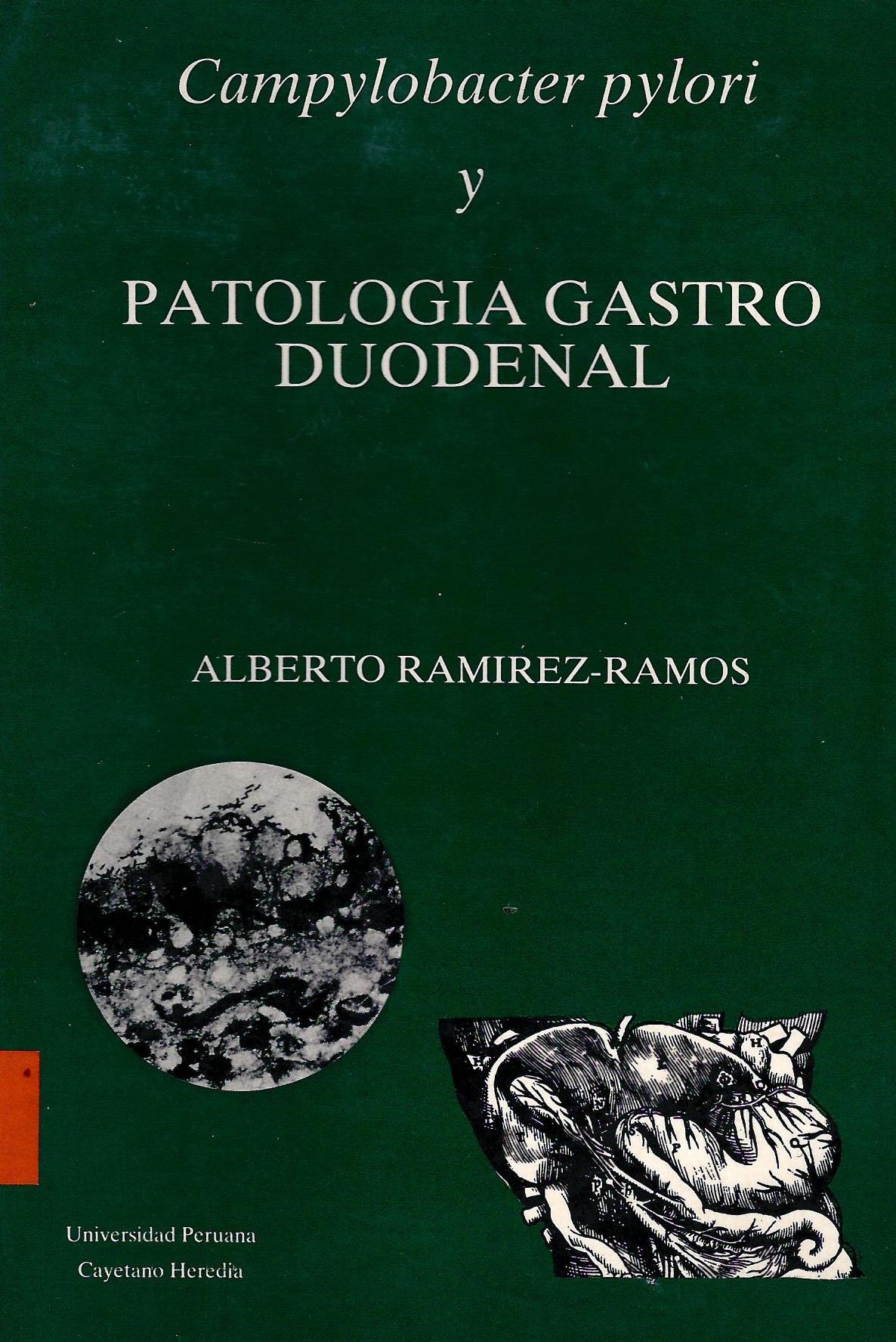 CAMPYLOBACTER PYLORI Y PATOLOGIA GASTRO DUODENAL
