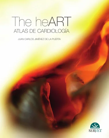 THE HEART. ATLAS DE CARDIOLOGIA