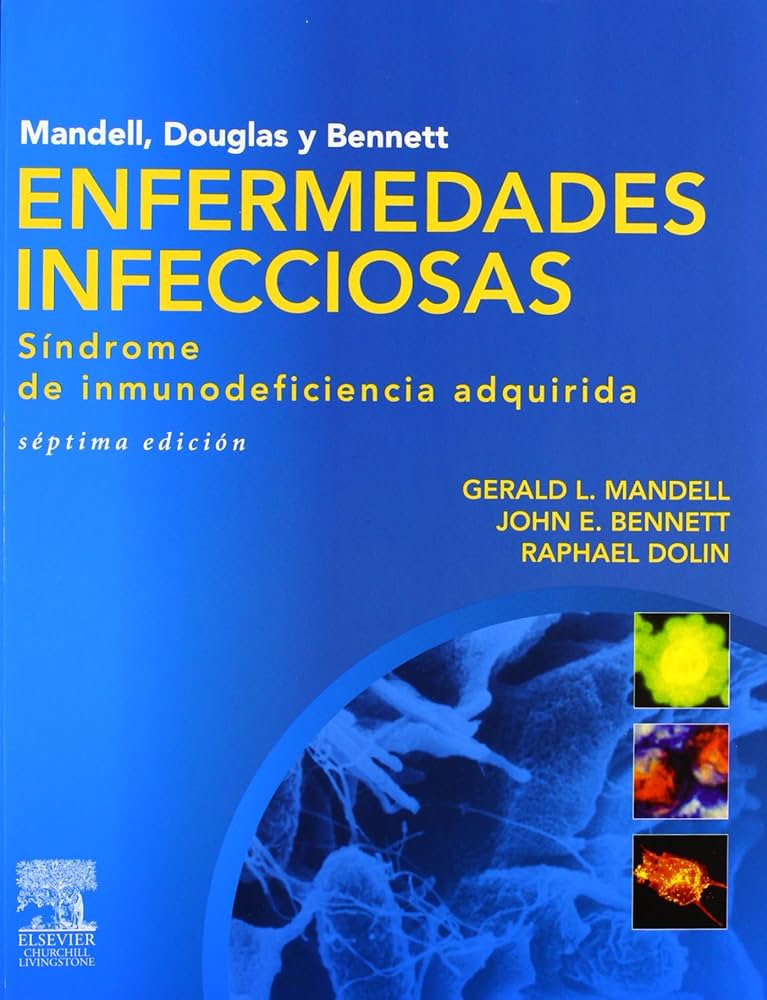 ENFERMEDADES INFECCIOSAS. SINDROME DE INMUNODEFICIENCIA ADQUIRIDA