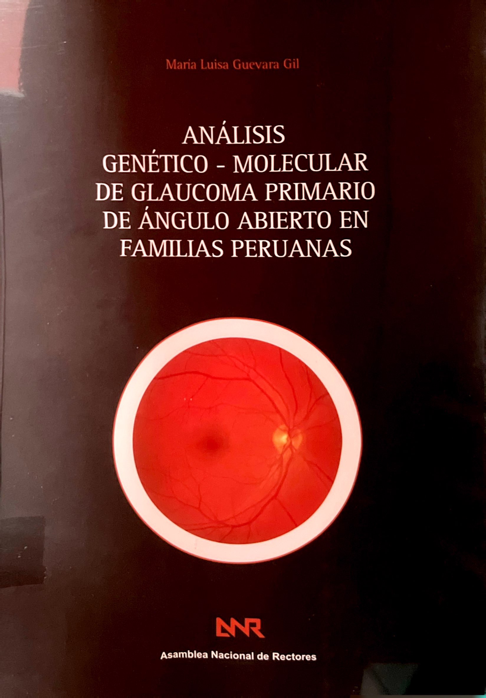 ANALISIS GENETICO - MOLECULAR DE GLAUCOMA PRIMARIO DE ANGULO