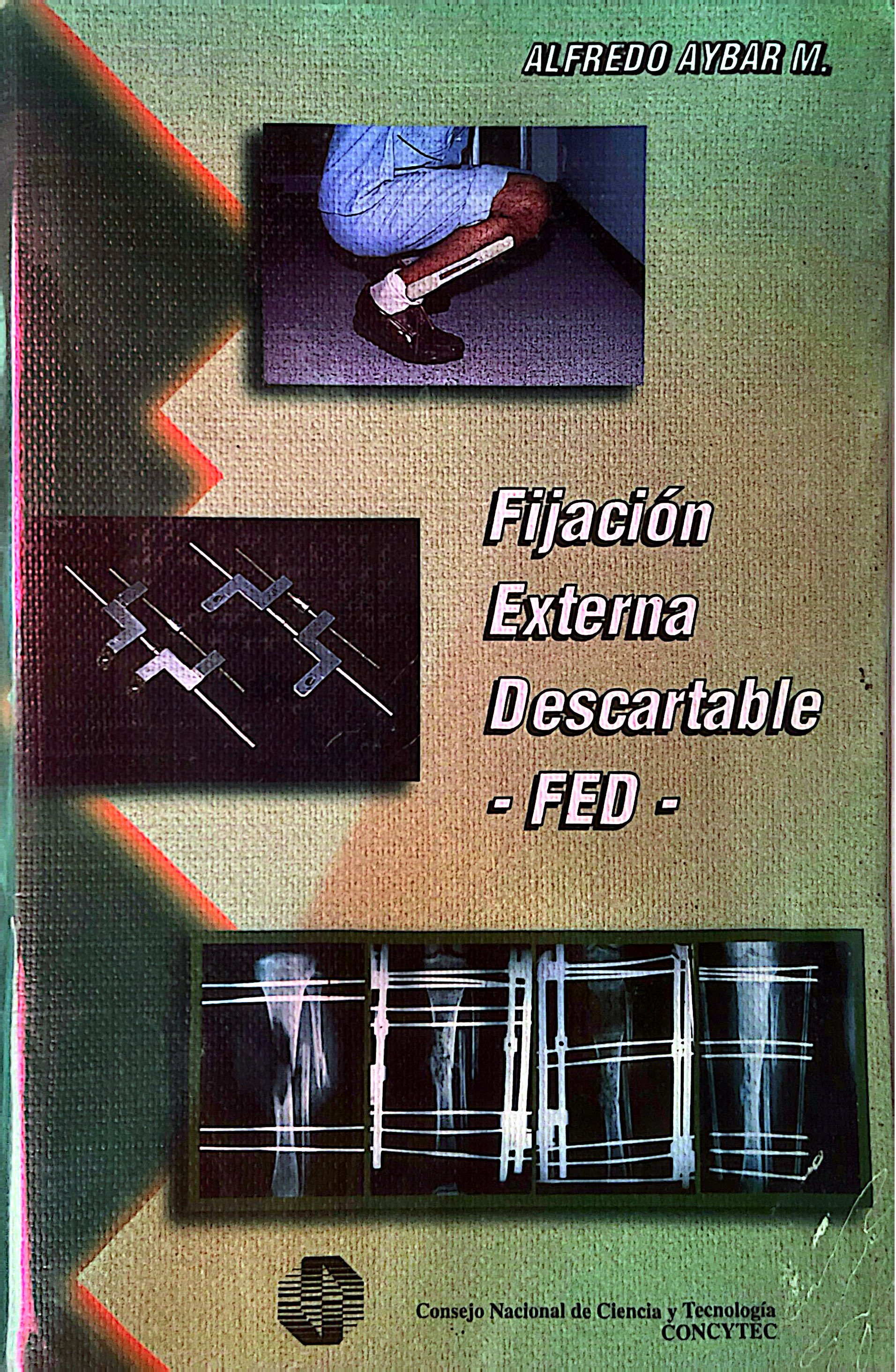 FIJACION EXTERNA DESCARTABLE FED
