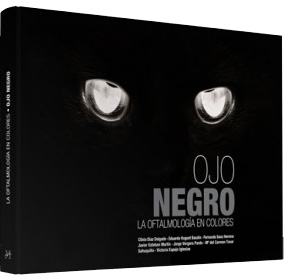 OJO NEGRO. LA OFTALMOLOGIA EN COLORES