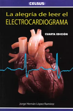 LA ALEGRIA DE LEER EL ELECTROCARDIOGRAMA
